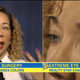 Image for article titled How Tiny's Eye Color Changing Surgery Actually Works